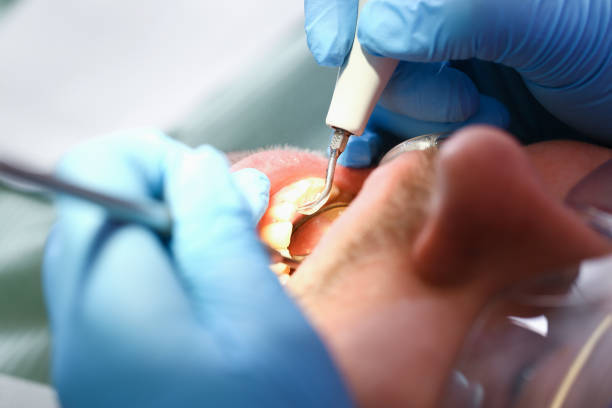 Best Emergency Pediatric Dental Care in Cambridge City, IN