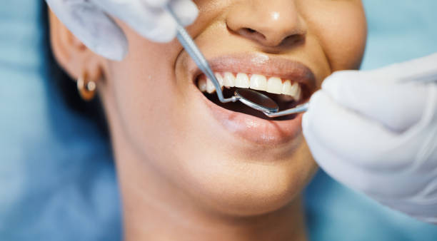 Best Emergency Treatment for Oral Infections in Cambridge City, IN